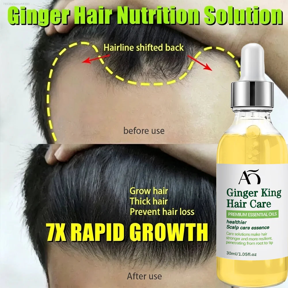 Ginger for Hair Care—Achieve Healthy, Thick Hair.